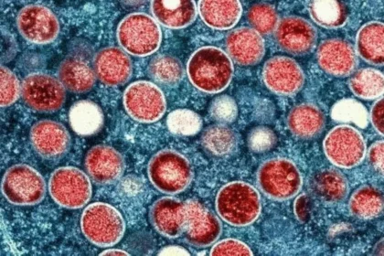 11 HIV patients from Davao test positive for mpox