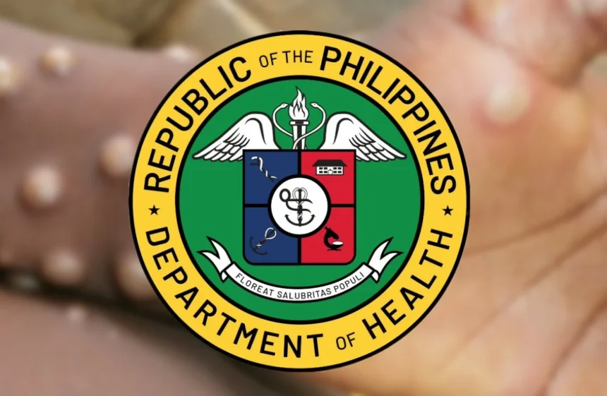 DOH allays fears: Philippines’ Mpox cases remain mild, self-limiting