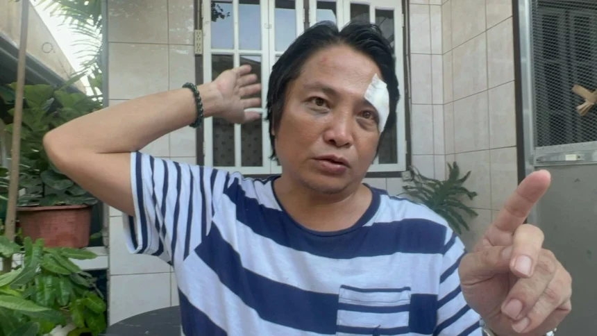 Nephew of ex-Mandaue City mayor accused of mauling village official